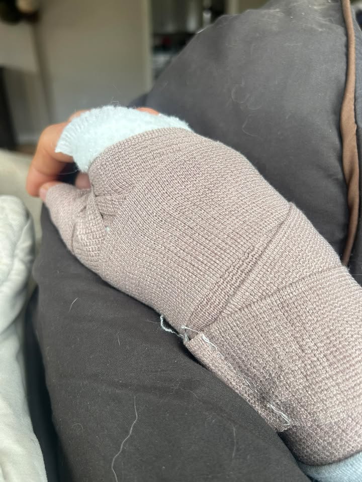 Hi families and kiddos I have had a few people reach out regarding lessons this year and Unfortunately I had to have surgery on my wrist today and will be out of commission for 6 weeks. However I do plan on doing lessons this year but starting later than usual with this speed bump.  Please be patient with me as I take some time to heal

Also added this year I will have very limited space for lessons as one of our lesson horses crossed the rainbow bridge this winter. So I will do my best to keep you all updated when I get closer to a start date!  Happy spring 🐴🌷🌸