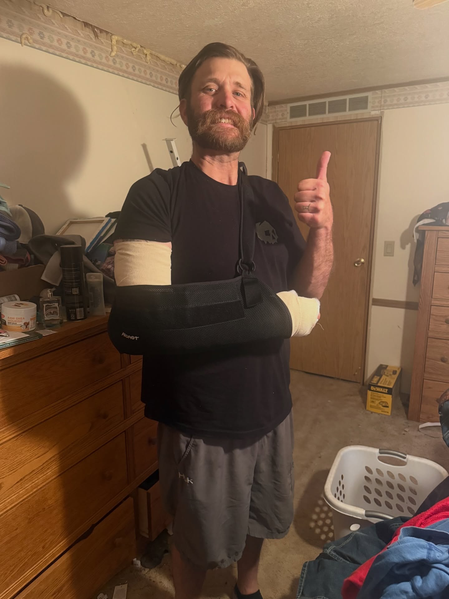 Well, as of two days ago, I officially went on injured reserve. Tore my bicep a couple of weeks ago and finally had it operated on this last Thursday. I’m gonna have to have this thing cranked at a 90° angle for the next two months and then it’s on to physical therapy.
